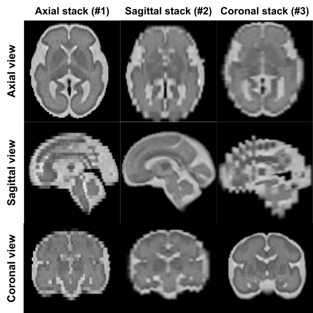 Low-resolution stacks from a simulated subject