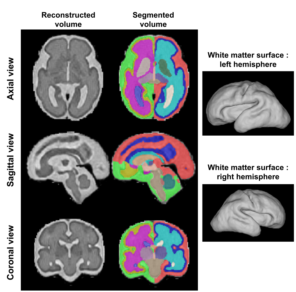 Results from the pipeline using a simulated subject